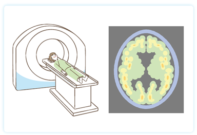 B.アミロイドPET検査（関連病院にて）